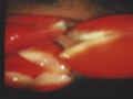 3 alkema1