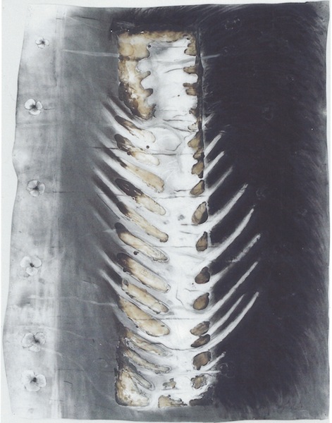 8 serton - spinal cord