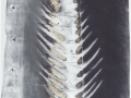 8 serton - spinal cord